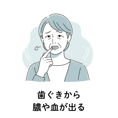 歯ぐきから膿や血が出る
