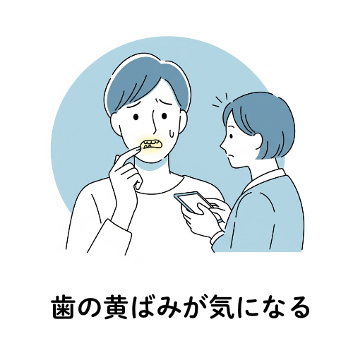 歯の黄ばみが気になる